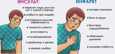 Ишемический инсульт